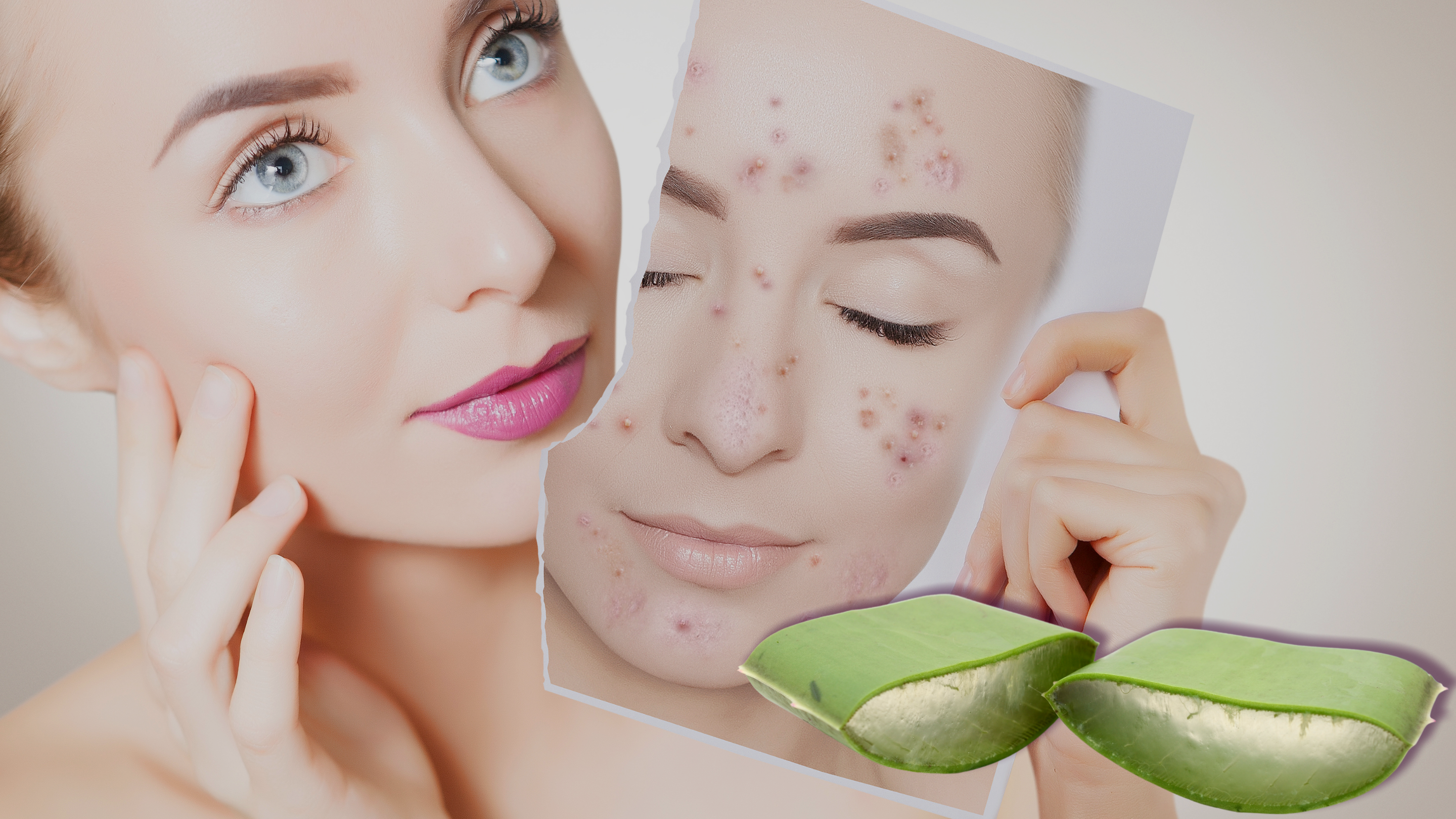 Aloe Skincare for Oily, Blemish-Prone Skin (Cosmetic Approach, Not Treatment)